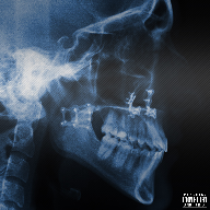 cover_remix_tsdtga